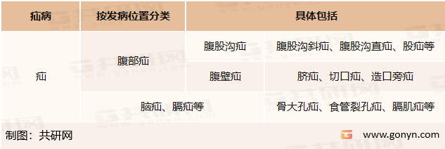 疝病按发病位置分类列示