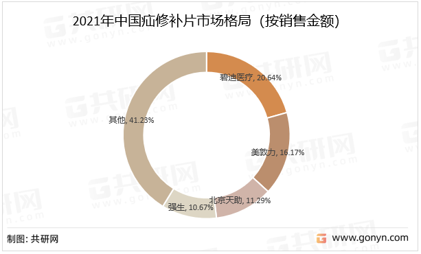 2021年中国疝修补片市场格局（按销售金额）
