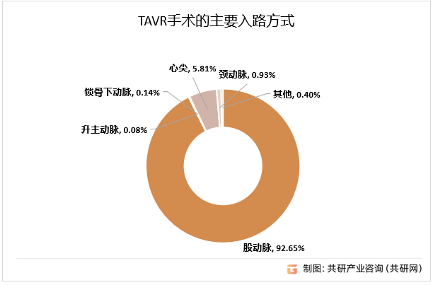 TAVR手术的主要入路方式