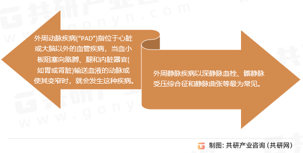外周血管疾病分类