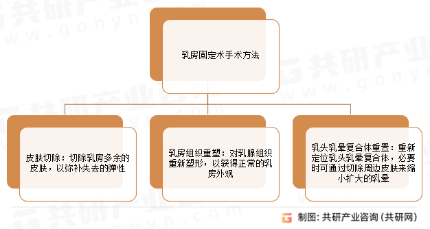 乳房固定术手术方法